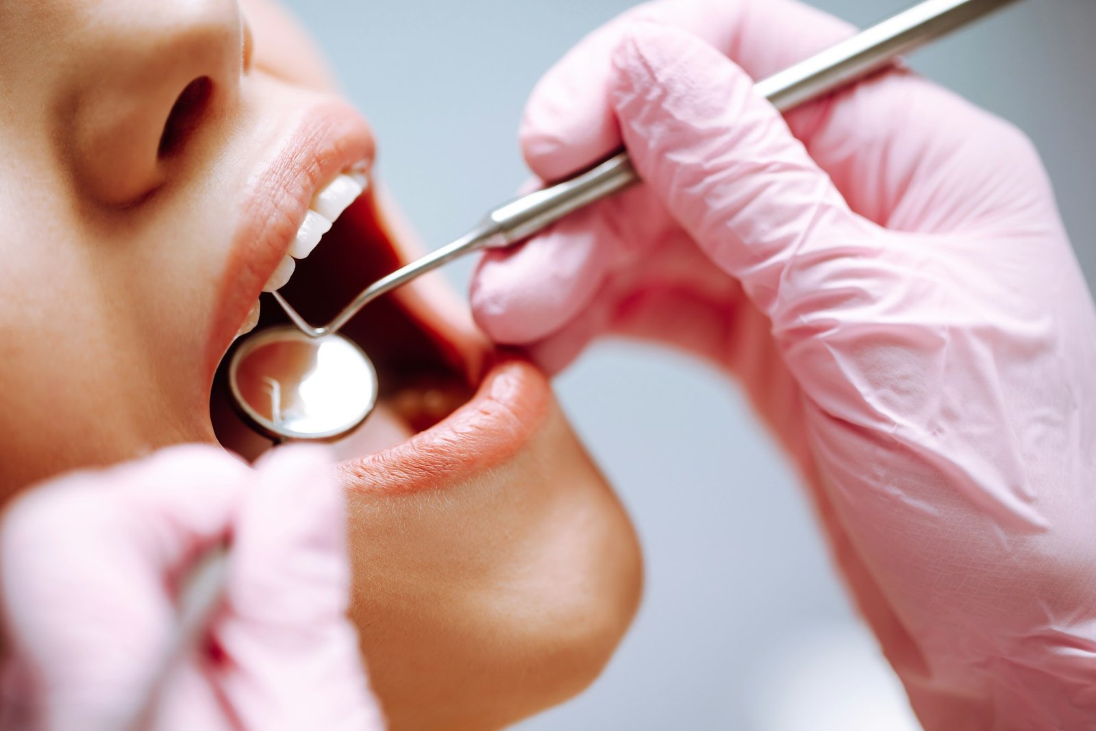 Teeth Cleaning & Scaling